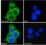 AGXT Antibody in Immunocytochemistry (ICC/IF)