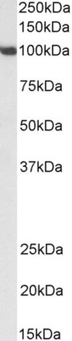 SP1 Antibody in Western Blot (WB)