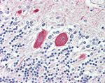 MTNR1B Antibody in Immunohistochemistry (Paraffin) (IHC (P))