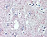 GABBR1 Antibody in Immunohistochemistry (Paraffin) (IHC (P))