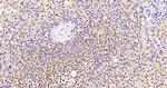 Thrombospondin 1 Antibody in Immunohistochemistry (Paraffin) (IHC (P))