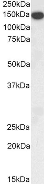 Thrombospondin 1 Antibody in Western Blot (WB)