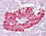 ATG4D Antibody in Immunohistochemistry (Paraffin) (IHC (P))