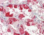 Clathrin Heavy Chain Antibody in Immunohistochemistry (Paraffin) (IHC (P))