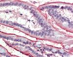 SGLT1 Antibody in Immunohistochemistry (Paraffin) (IHC (P))