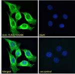 TLR4 Antibody in Immunocytochemistry (ICC/IF)