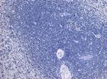 TLR4 Antibody in Immunohistochemistry (Paraffin) (IHC (P))