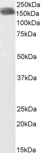 CLIP1 Antibody in Western Blot (WB)