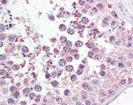 RAP80 Antibody in Immunohistochemistry (Paraffin) (IHC (P))