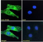 EphB6 Antibody in Immunocytochemistry (ICC/IF)