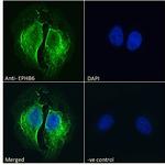 EphB6 Antibody in Immunocytochemistry (ICC/IF)