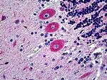 EphB6 Antibody in Immunohistochemistry (Paraffin) (IHC (P))