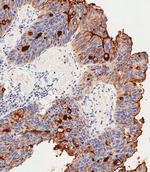 CEACAM1 Antibody in Immunohistochemistry (Paraffin) (IHC (P))