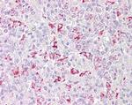 PFKFB2 Antibody in Immunohistochemistry (Paraffin) (IHC (P))