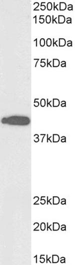 ACAT1 Antibody in Western Blot (WB)