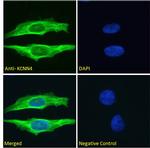 KCNN4 Antibody in Immunocytochemistry (ICC/IF)