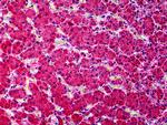 KCNN4 Antibody in Immunohistochemistry (Paraffin) (IHC (P))