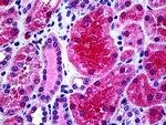 KCNN4 Antibody in Immunohistochemistry (Paraffin) (IHC (P))