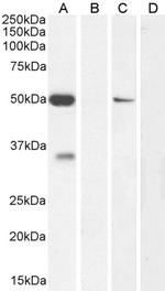 KCNN4 Antibody in Western Blot (WB)