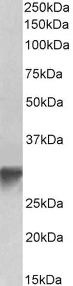 GOLPH3 Antibody in Western Blot (WB)