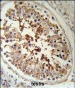 SERPINH1 Antibody in Immunohistochemistry (Paraffin) (IHC (P))