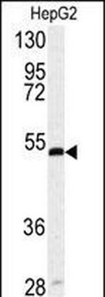 SERPINH1 Antibody in Western Blot (WB)