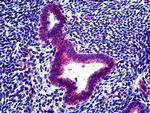 CLCN2 Antibody in Immunohistochemistry (Paraffin) (IHC (P))