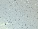 CLCN2 Antibody in Immunohistochemistry (Paraffin) (IHC (P))