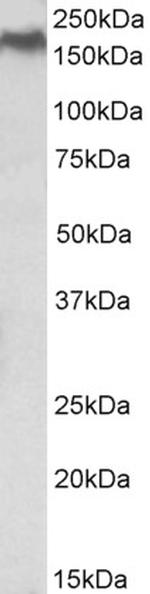 NPC1 Antibody in Western Blot (WB)