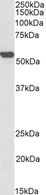 ALDH2 Antibody in Western Blot (WB)