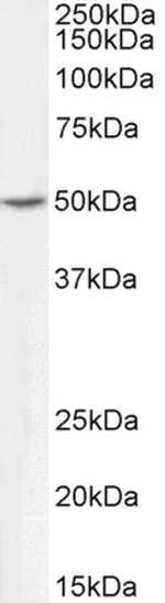 ALDH9A1 Antibody in Western Blot (WB)