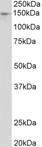 PEX1 Antibody in Western Blot (WB)