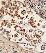 BCL6 Antibody in Immunohistochemistry (Paraffin) (IHC (P))