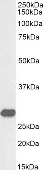 ETFB Antibody in Western Blot (WB)