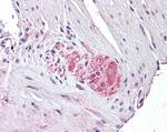 NTN4 Antibody in Immunohistochemistry (Paraffin) (IHC (P))