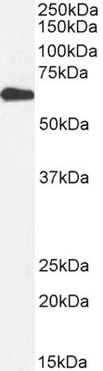 AMPK alpha-2 Antibody in Western Blot (WB)