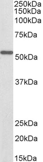 ALDH6A1 Antibody in Western Blot (WB)