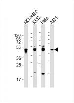 Cytokeratin 18 Antibody in Western Blot (WB)