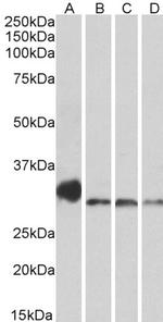 NEK7 Antibody in Western Blot (WB)