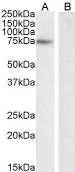 NOX2 Antibody in Western Blot (WB)