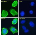 NOX5 Antibody in Immunocytochemistry (ICC/IF)