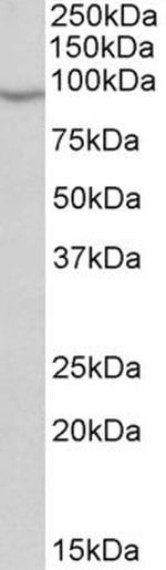 NOX5 Antibody in Western Blot (WB)