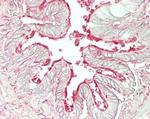 ARL6 Antibody in Immunohistochemistry (Paraffin) (IHC (P))