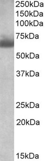 BBS4 Antibody in Western Blot (WB)