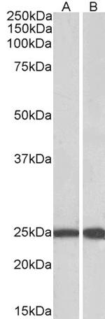 RAN Antibody in Western Blot (WB)