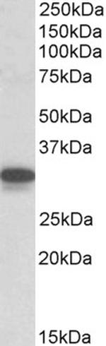 CYB5R3 Antibody in Western Blot (WB)