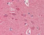 CROT Antibody in Immunohistochemistry (Paraffin) (IHC (P))