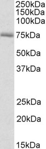 CROT Antibody in Western Blot (WB)