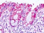 Galectin 3 Antibody in Immunohistochemistry (Paraffin) (IHC (P))