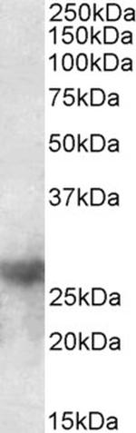 Galectin 3 Antibody in Western Blot (WB)